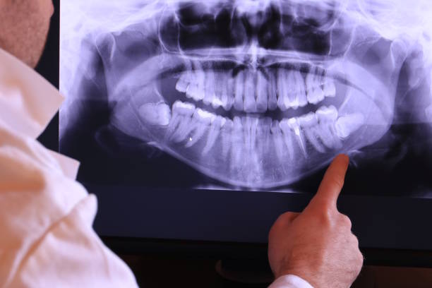 Best Orthodontic Emergency Dentist in New Pek, IN