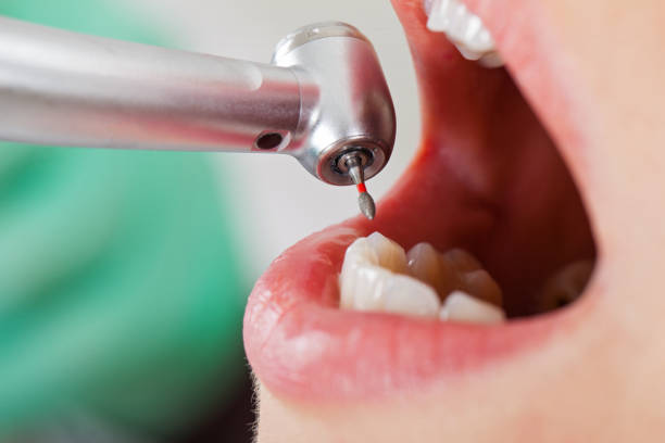 Best Mobile Emergency Dentist in New Pek, IN